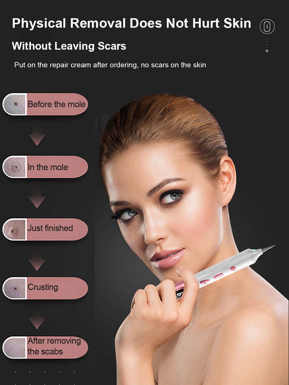 Stylo Plasma élimination de grains de beautés, verrues et autres imperfections